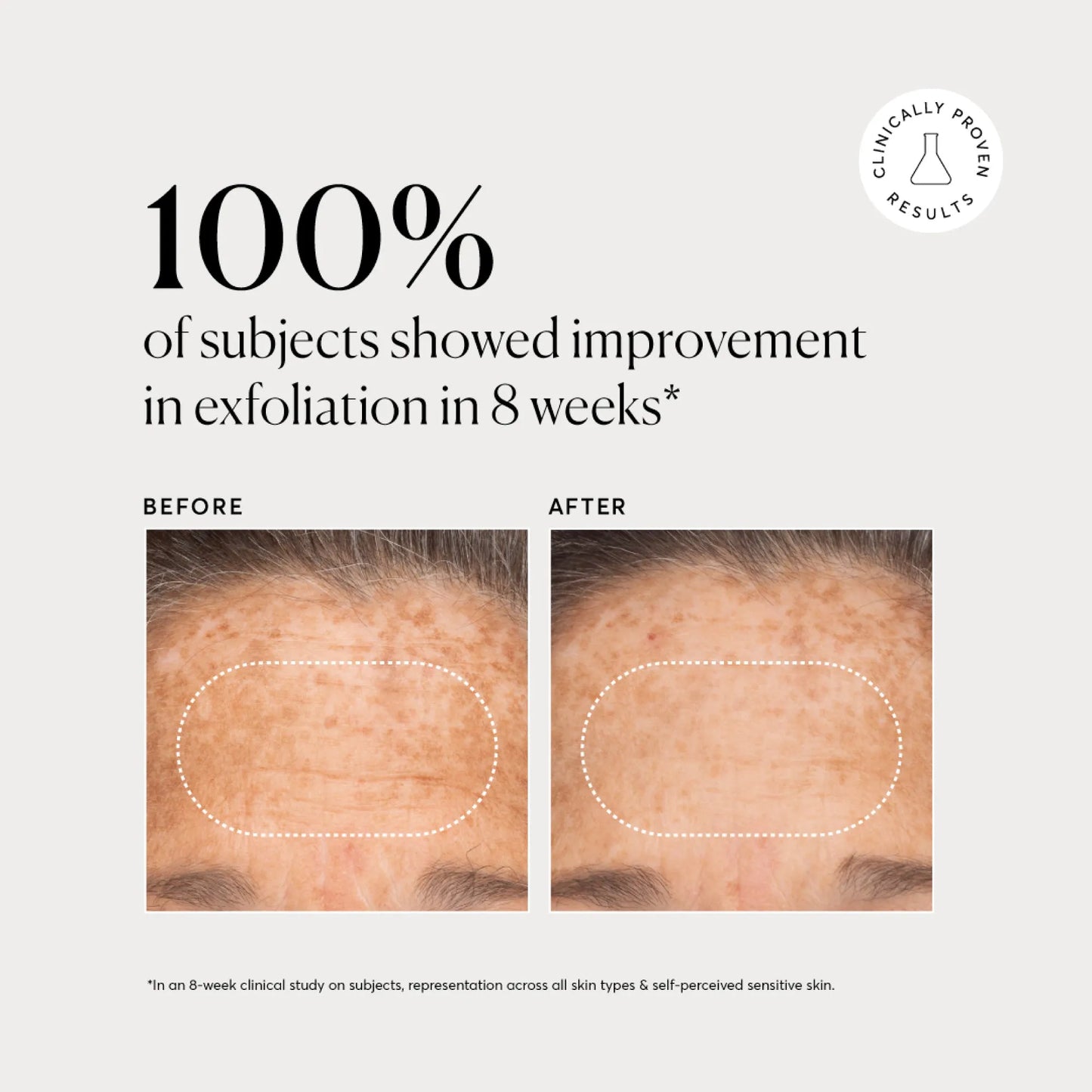 bha-liquid-exfoliant-2-l3 NATR-10027-Alt-Images-BHA-Liquid-Exfoliant-2_-03.webp