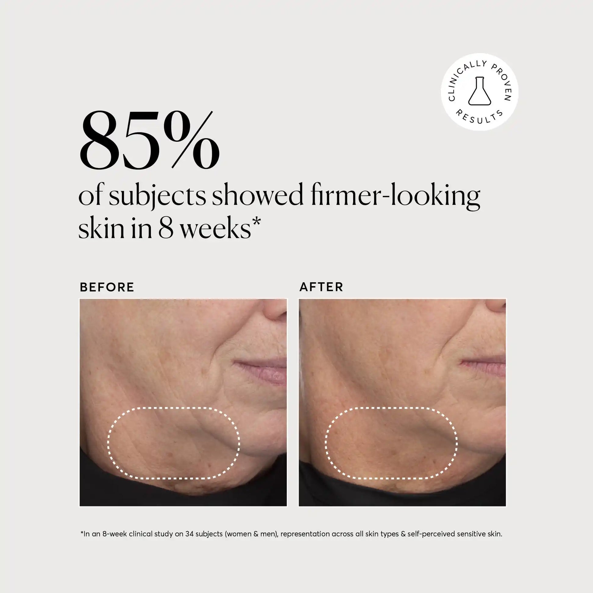 retinol-complex-serum-w0 NATR-10034-Alt-Images-Retinol-Complex-Serum-04.webp